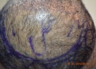 crown-area-orientation