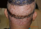 day-1-fue