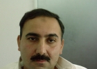 Hair Transplant result photo