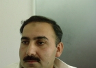 Hair Transplantation Pakistan photo