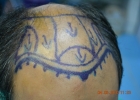 follicle-clinic-lahore