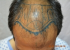 hair-clinic-lahore