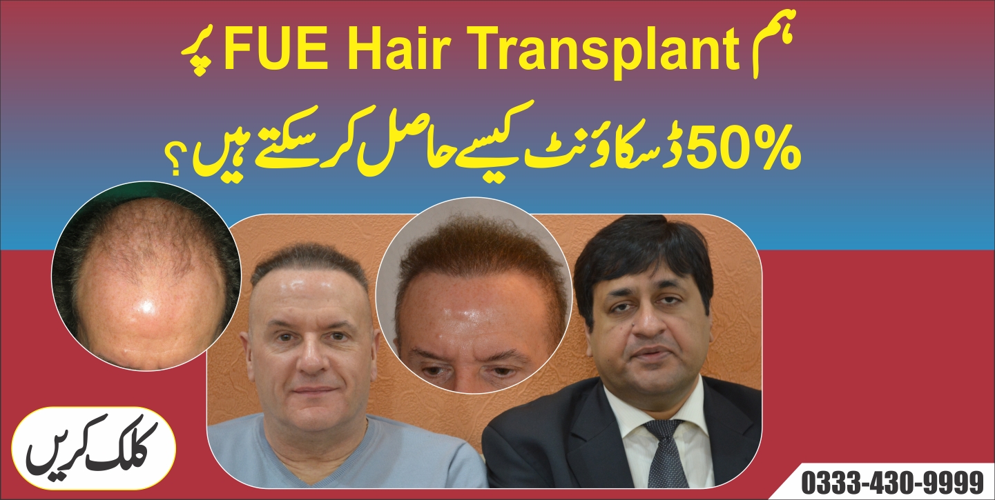 FUE Hair Transplant Clinic Baldness Solution In Pakistan