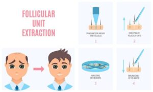 Follicular unit extraction