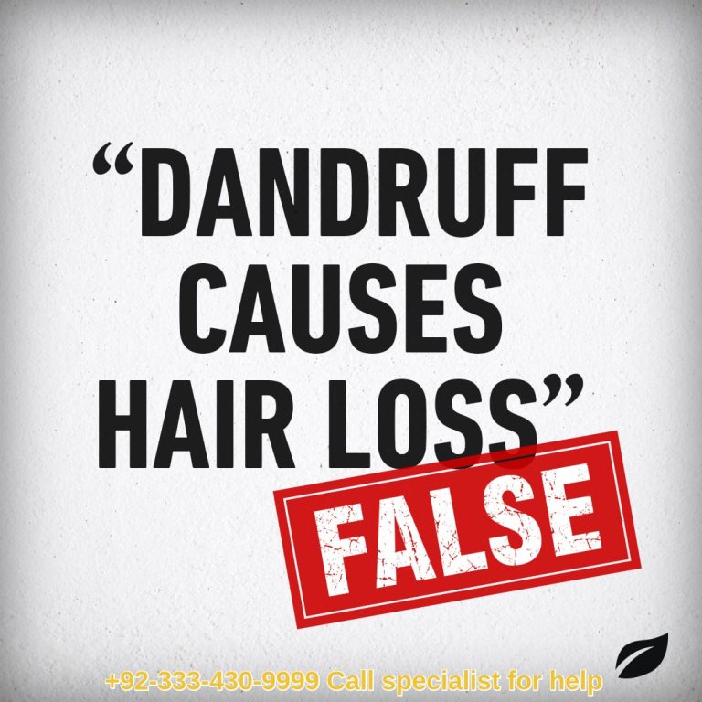 Dandruff and hair loss link