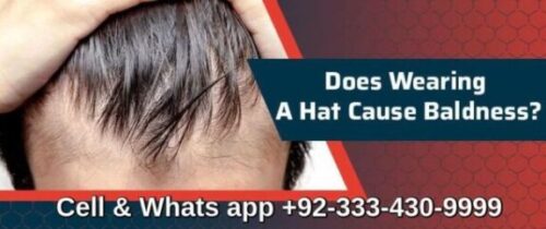 Does wearing a hat cause hair thinning