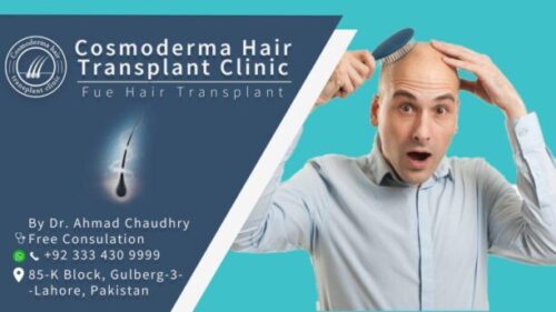Read more about the article Hair transplant for men