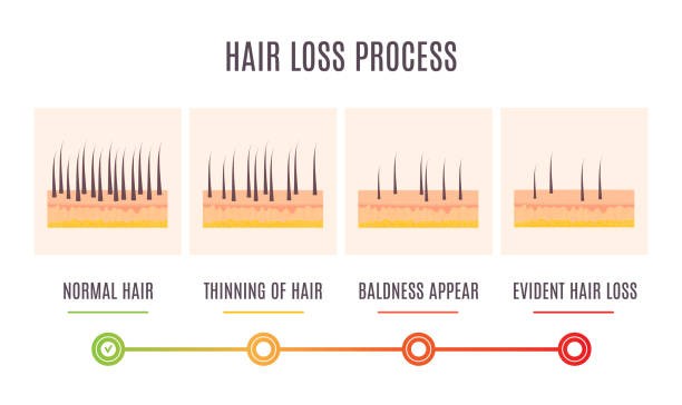 Hair loss process