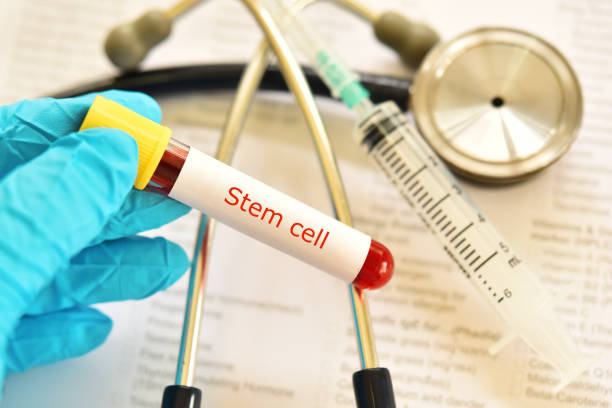 Stem cell hair transplant Pakistan